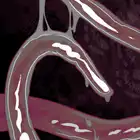 014-015