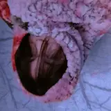 Syz